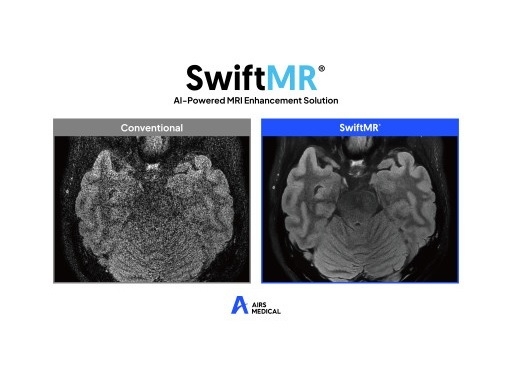 “MRI 촬영시간 최대 50%↓”…에어스메디컬, 서울대병원에 ‘스위프트엠알’ 공급